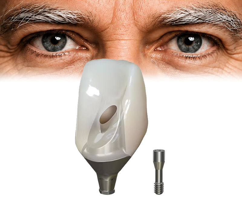 Eyes and a zirconia crown illustrating BlueSkyBio First Fit case review