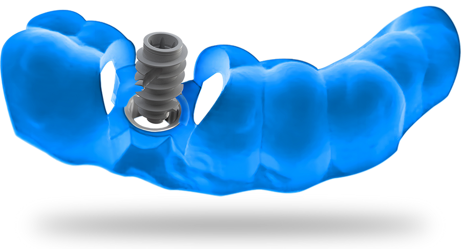 Guided dental implant surgery model with surgical guide