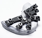 Picture of Advanced full-arch implant scanning system option for ScanLadder- <span style="color:#ff0000;">Coming Soon!</span> product (BlueSkyBio.com)