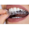 Picture of Orthodontics (BlueSkyBio.com)