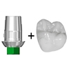 Picture of Digital Abutment & Crown $149 (BlueSkyBio.com)