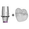 Picture of SKY-Base Abutment & Crown $149 (BlueSkyBio.com)