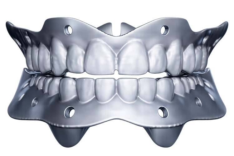 Picture of Glenn Denture Tray (BlueSkyBio.com)