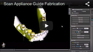 Scan Appliance Guide Fabrication