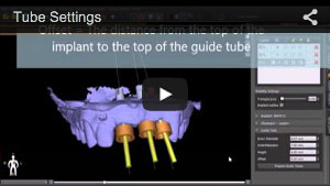 Tube Settings for Guide Fabrication