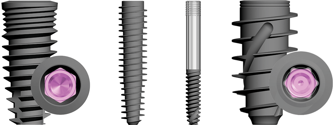 Other Implant Systems